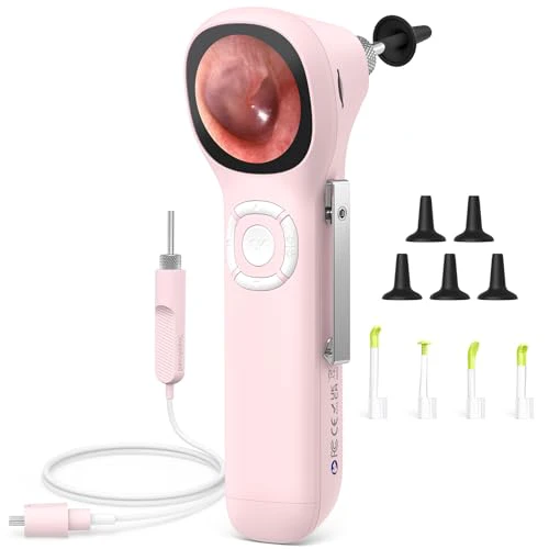 ScopeAround Digital Otoscope w/IPS Screen, 720p HD Smart Video Otoscope with Light, Ear Scope Otoscope with Camera Ear Wax Removal Camera, Ear Checker, Power On and Go, Pink